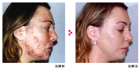 高崎 クリアタッチ 城本クリニック高崎院